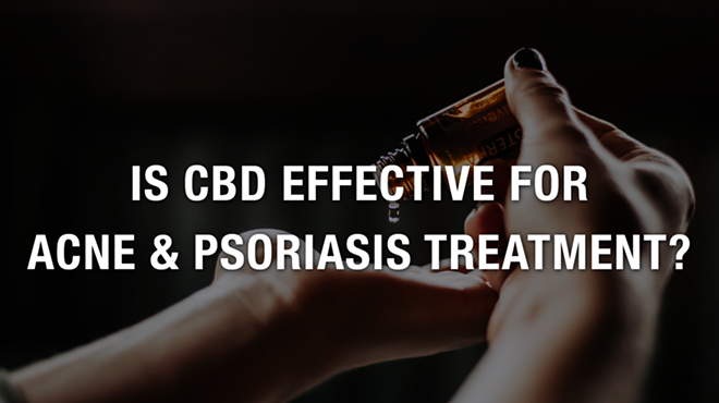 Is CBD Effective for Acne & Psoriasis Treatment?