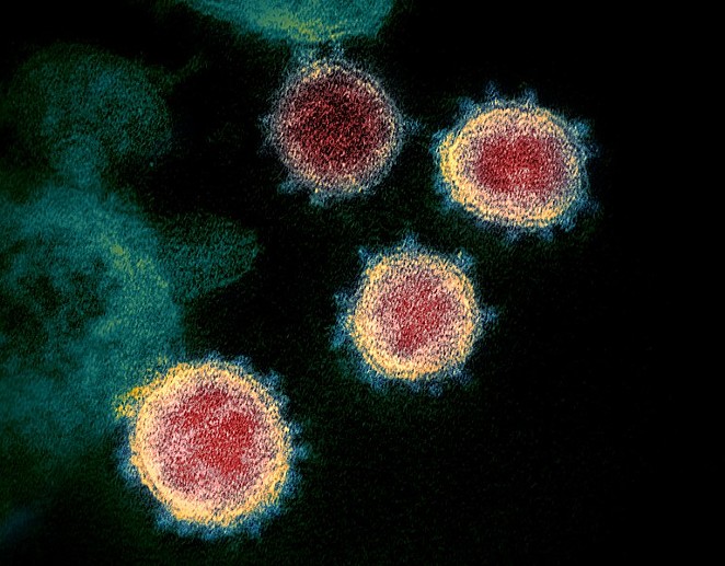The novel coronavirus that causes COVID-19, as seen under an electron microscope - WIKIMEDIA COMMONS / NIAID