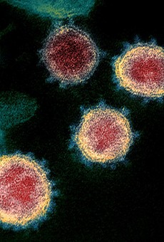 The novel coronavirus that causes COVID-19, as seen under an electron microscope